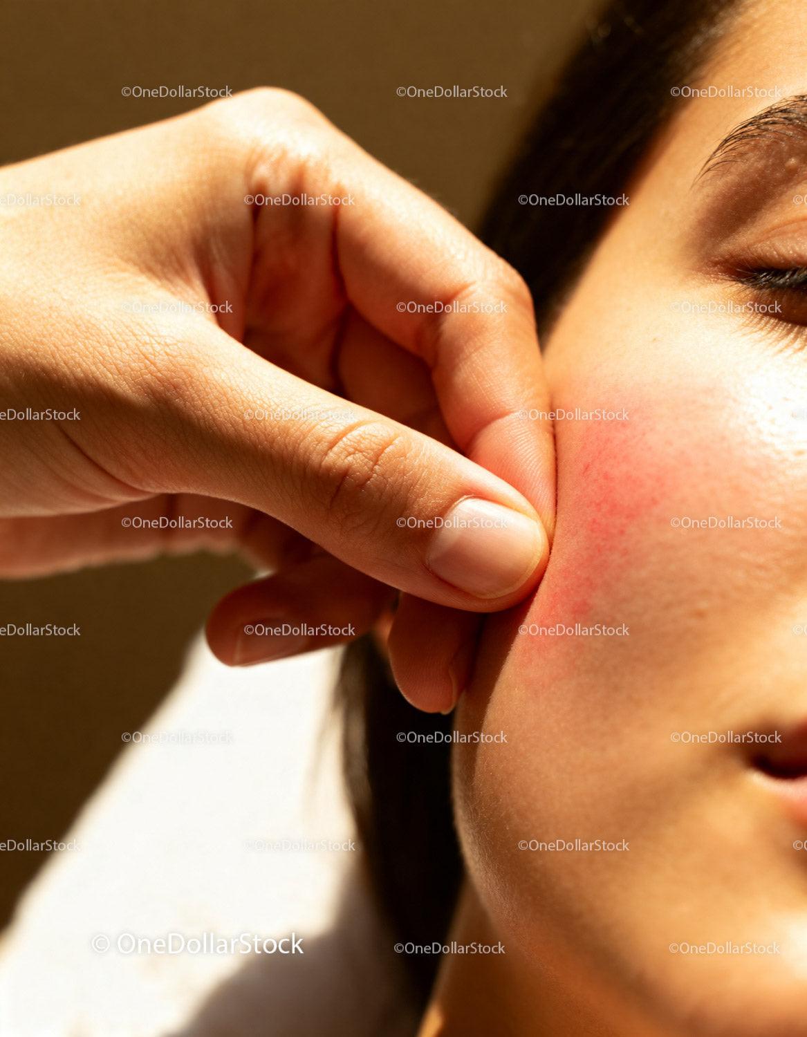 Woman gently pressing red irritated cheek skin