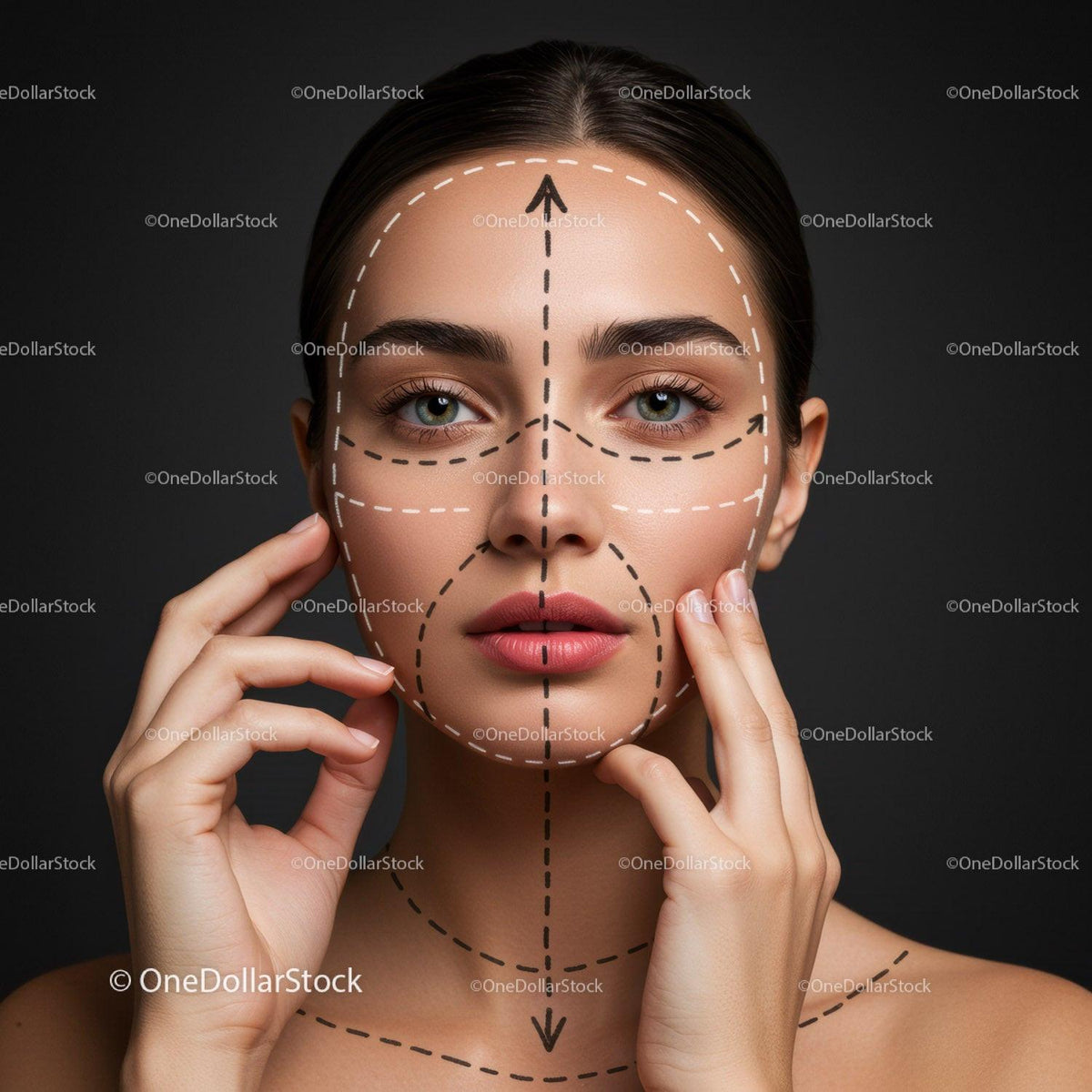 Woman with Facial Markings for Cosmetic Surgery and Skin Treatment