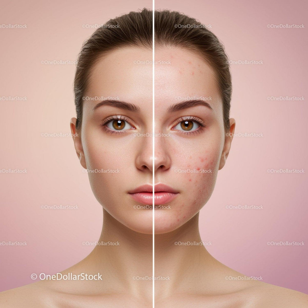 Beautiful Woman Showing Clear Skin and Acne Improvement Effect