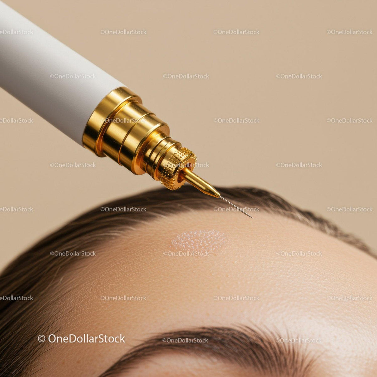 Close-Up of a Botox Injection Being Applied on Forehead