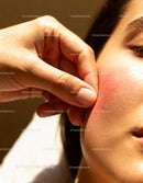 Woman gently pressing red irritated cheek skin