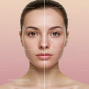 Close-Up of a Young Woman with Clear Skin and Acne on One Half