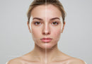 Portrait of Young Woman with Clear Skin and Beautiful Complexion