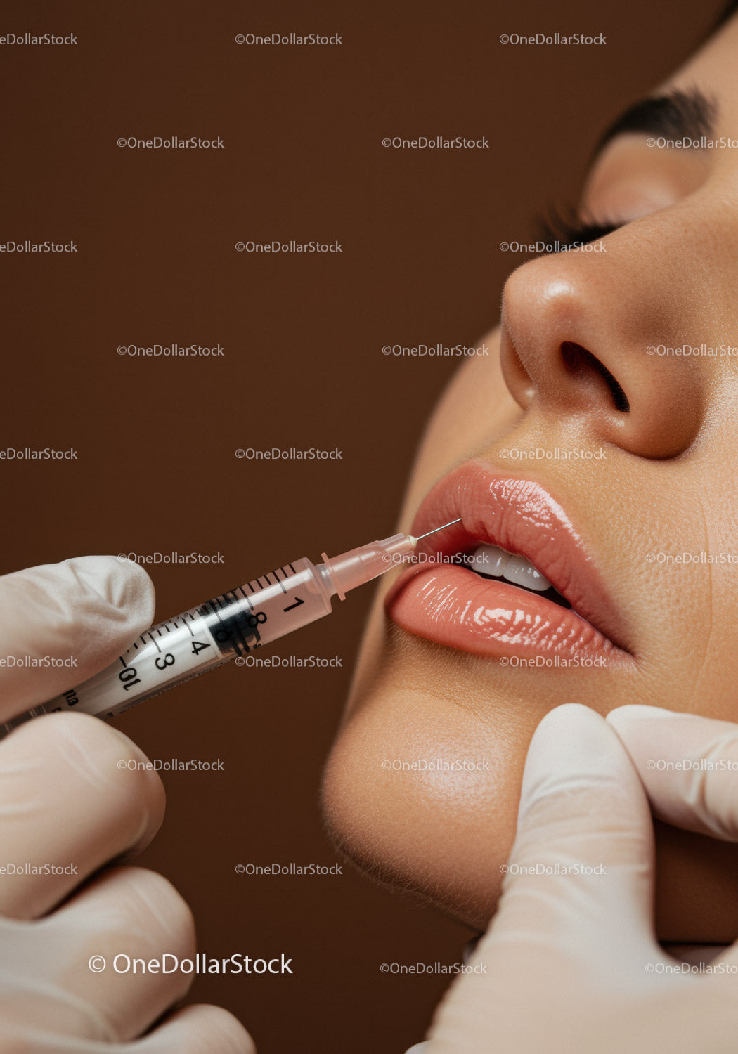 Close-Up of Lip Injection Procedure with Syringe for Lip Enhancement