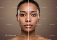 Close-Up Portrait of a Young Woman with Clear Skin and acne scars