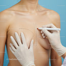 Breast Augmentation Surgery Preparation with Markings and Healthcare