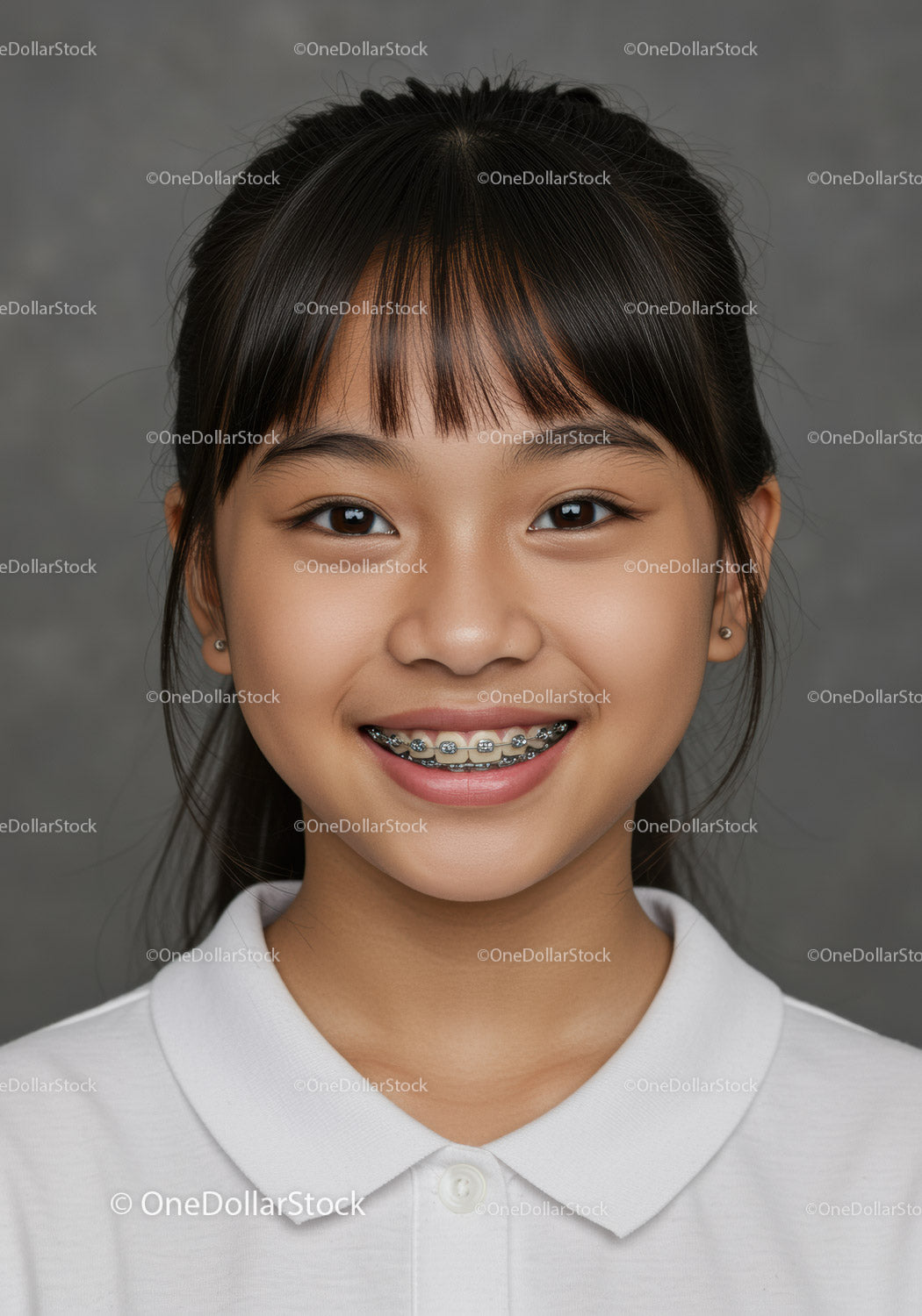 Young Girl with Braces Smiling Portrait in Casual White Shirt