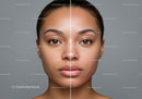 Close-Up of a Woman's Face Showing Before and After Skincare Results