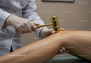 Therapist Using Ultrasound Device on Patient's Leg in Medical Treatment