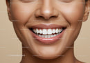 Close-up of smiling woman with perfect white teeth
