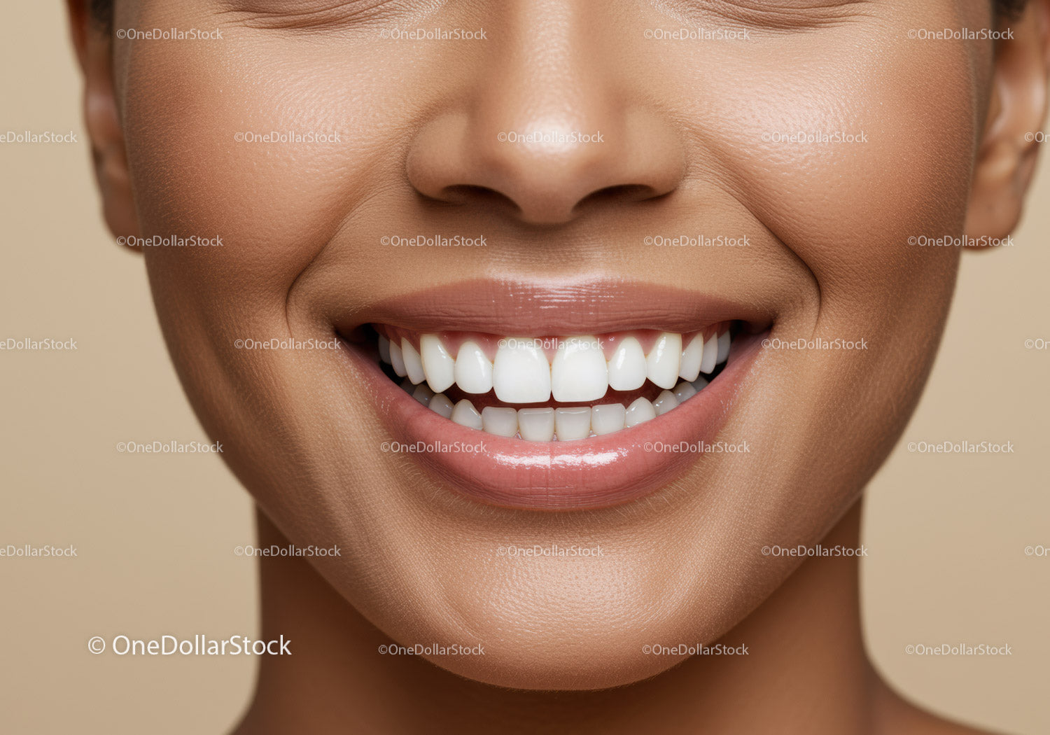Close-up of smiling woman with perfect white teeth