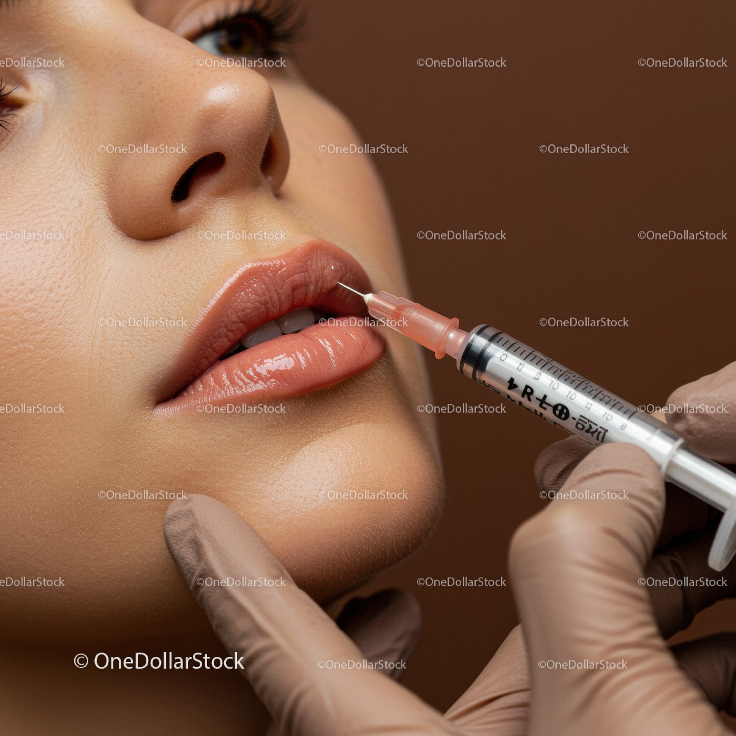 Close-up of Lip Filler Injection During Cosmetic Beauty Treatment