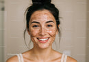 Young Woman with Acne Smiles Brightly with Clear Skin