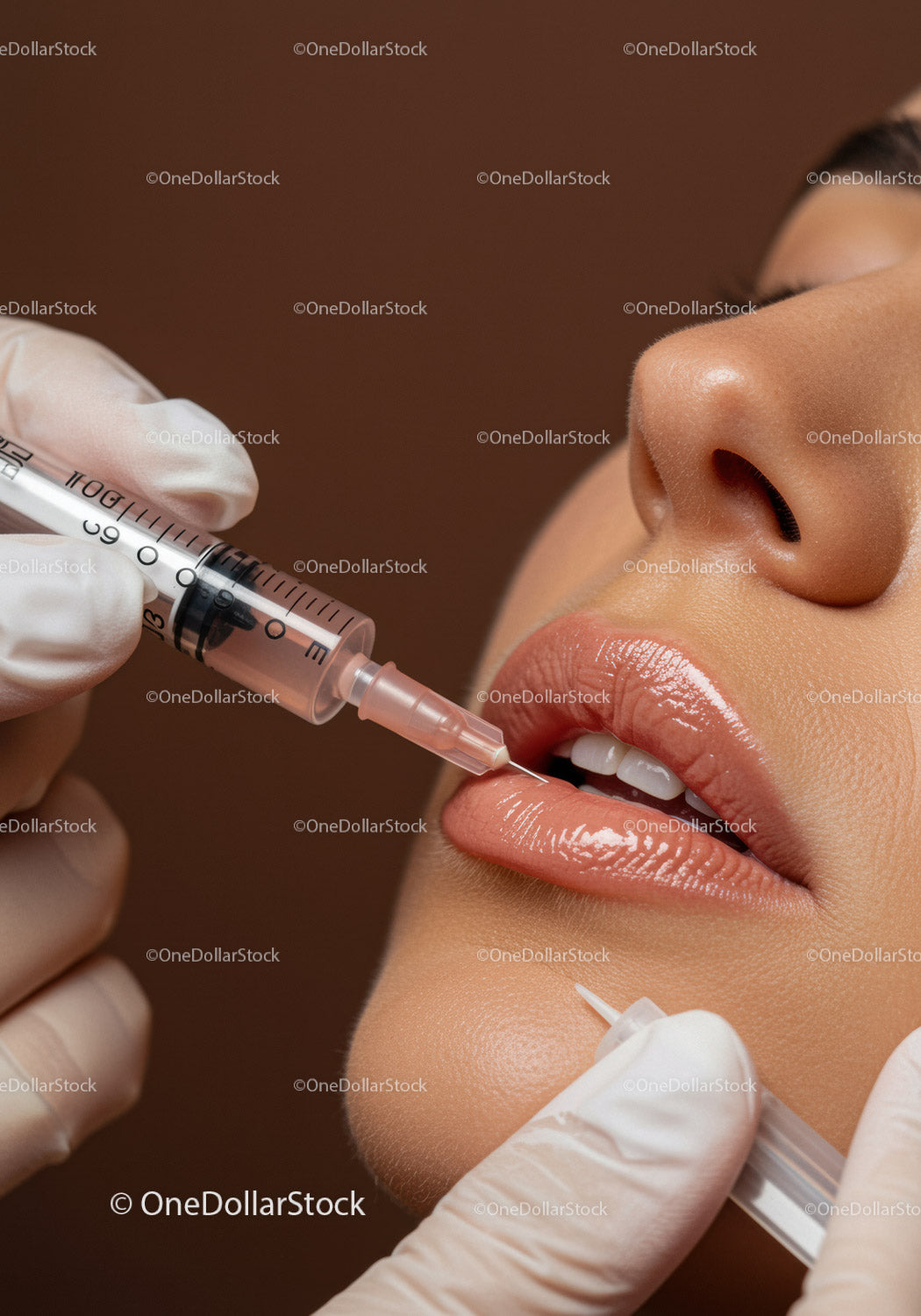 Close-up of Woman Receiving Lip Filler Injection at Beauty Clinic