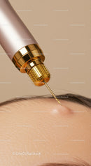 Close-Up of Cosmetic Facial Injection with Gold-Tipped Needle