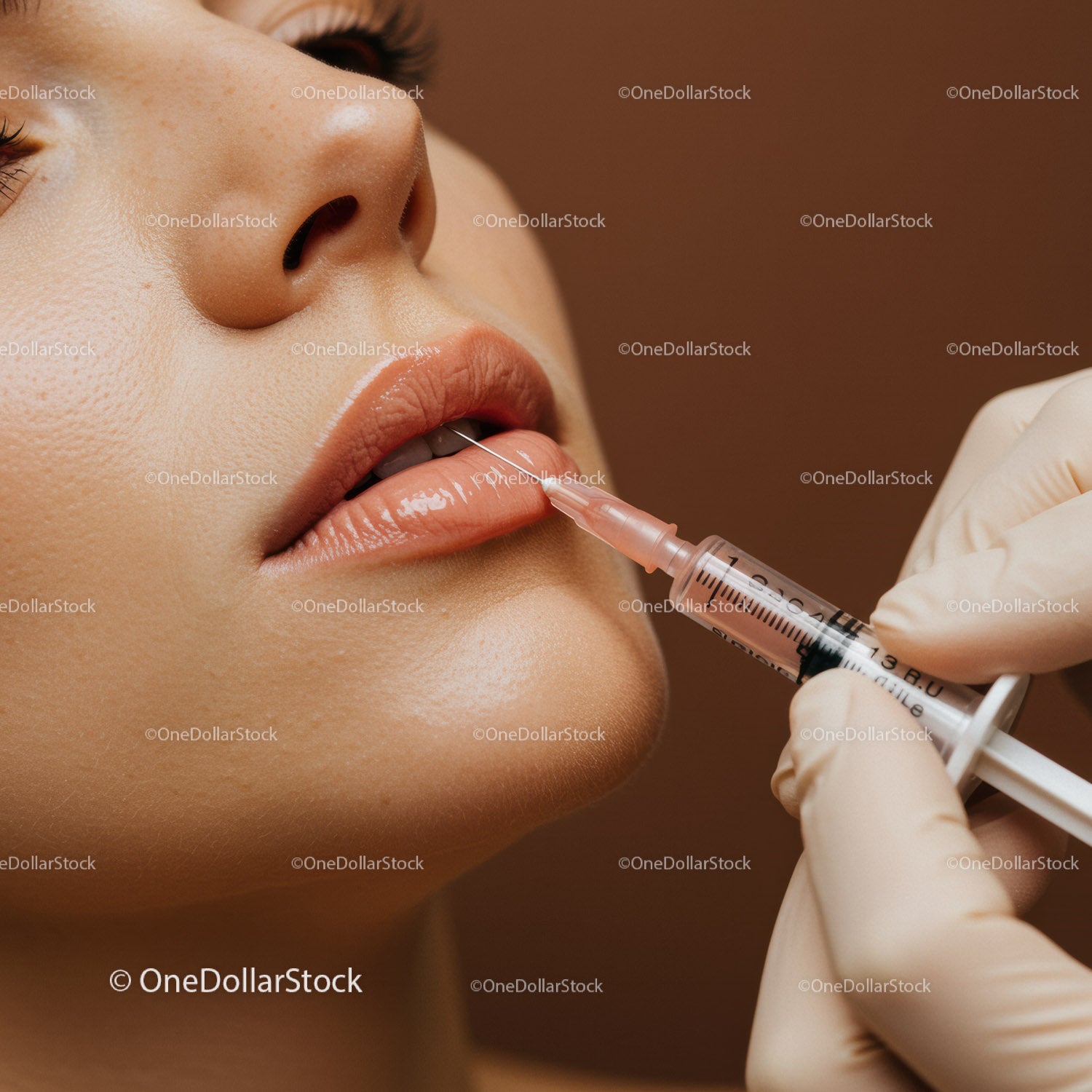 Lip Augmentation in Beauty Clinic with Medical Syringe