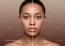 Before and After Acne Treatment Skin Transformation with Clear Complexion