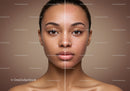 Portrait of a Young Woman Showing Skin Improvement and Clear Complexion