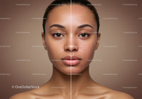 Portrait of a Young Woman Showing Skin Improvement and Clear Complexion