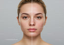 Young Woman with Clear Skin and Acne-prone Skin
