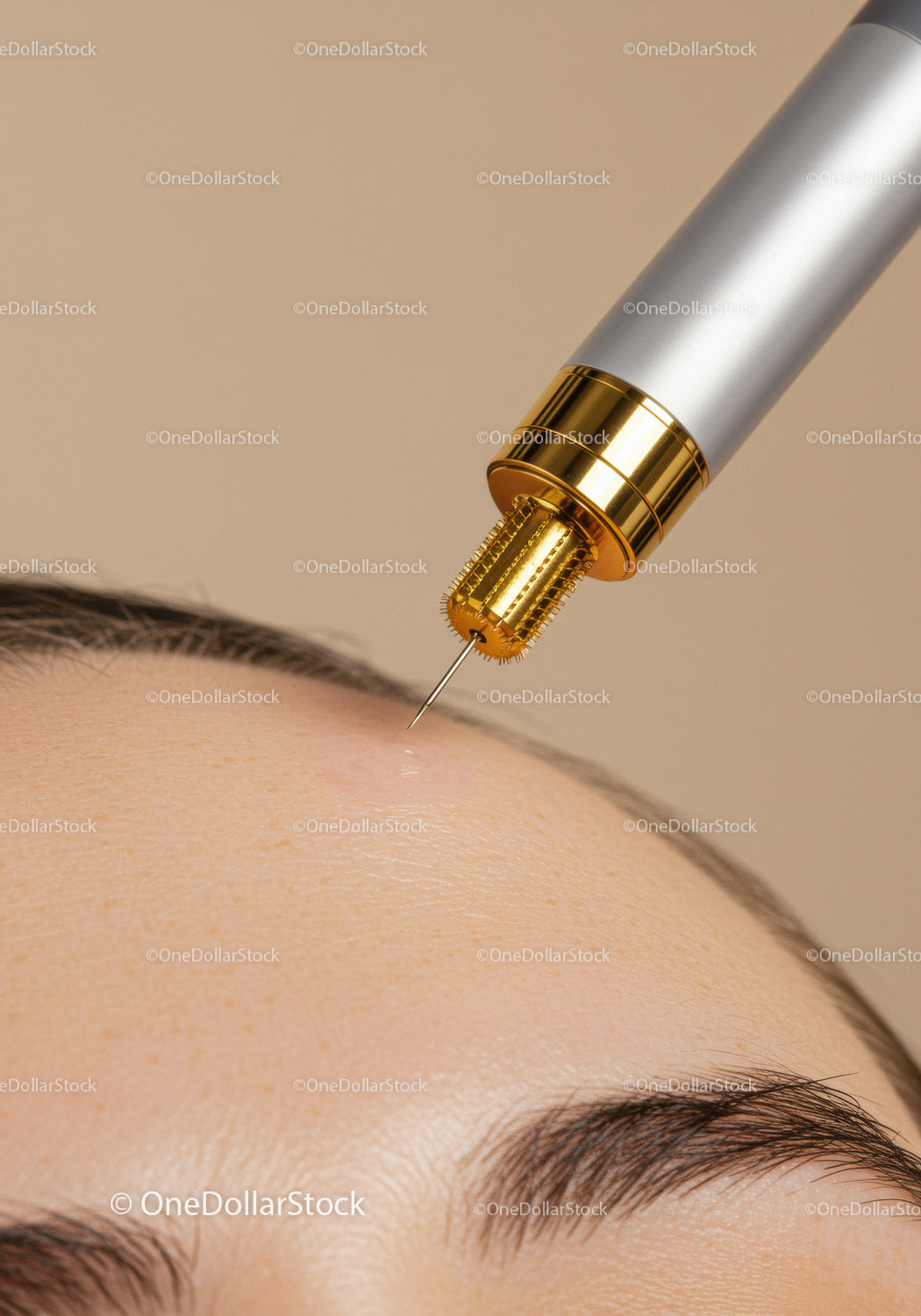 Cosmetic Injection During Skin Rejuvenation Treatment with Medical Device