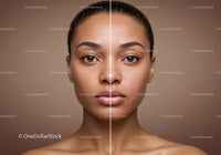 Contrast in Skin Clarity with Focus on Flawless and Acne-prone Skin