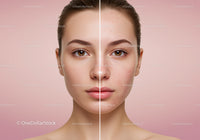Clear Complexion Skin After Acne Treatment with Smooth Texture