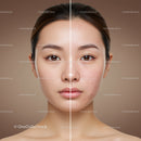 Skincare Transformation and Acne Treatment Before and After Results