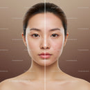 Facial Skin Comparison Showing Acne Reduction and Clear Skin