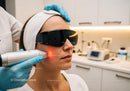 Laser Skin Rejuvenation Procedure with Modern Medical Equipment