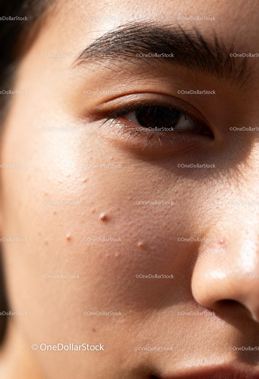 Close-up of young woman with textured skin and moles