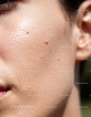 Close-up of natural skin texture with small blemishes