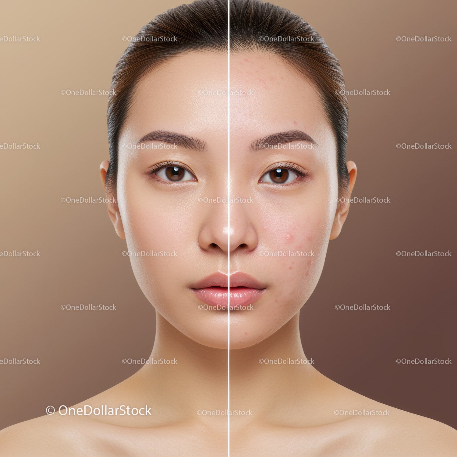 Clear Skin Transformation of Woman Showing Acne Reduction and Radiance