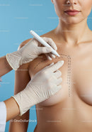 Woman Preparing for Breast Surgery with Surgical Markings and Medical Team