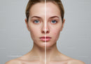 Portrait of a Young Woman with Clear Skin and Acne Prone Skin