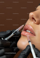 Close-Up of Lip Injection Procedure with Dermal Filler and Medical Syringe
