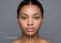 Split Face Portrait of Young Woman Showing Skin Texture Before and After Skincare