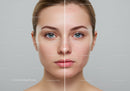 Clear Skin Transformation with Acne Treatment and Skin Rejuvenation