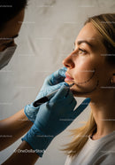 Female Patient Preparing for Facial Cosmetic Surgery With Face Markings
