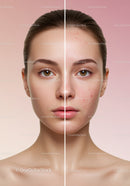 Close-up of a Young Woman's Face Showing Clear Skin and Acne Treatment