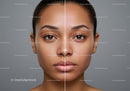 Close-up of a Woman's Face Showing Skin Before and After Treatment