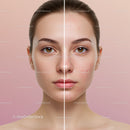 Women Facial Skin Care Before and After Acne Treatment Showing Flawless Skin