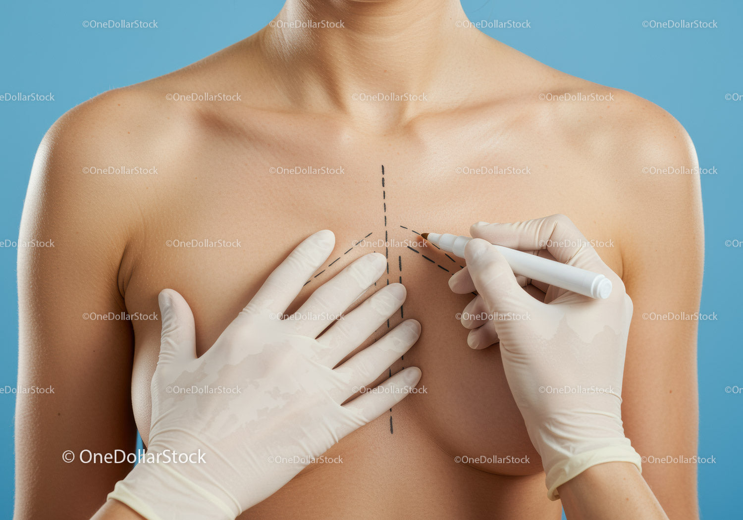 Medical Breast Examination Procedure in Healthcare Setting