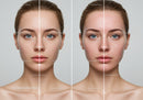 Before and After Skin Treatment Showing Clear and Acne-Prone Skin