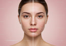Clear Skin Skin Care Comparison Showing Acne Reduction and Radiance