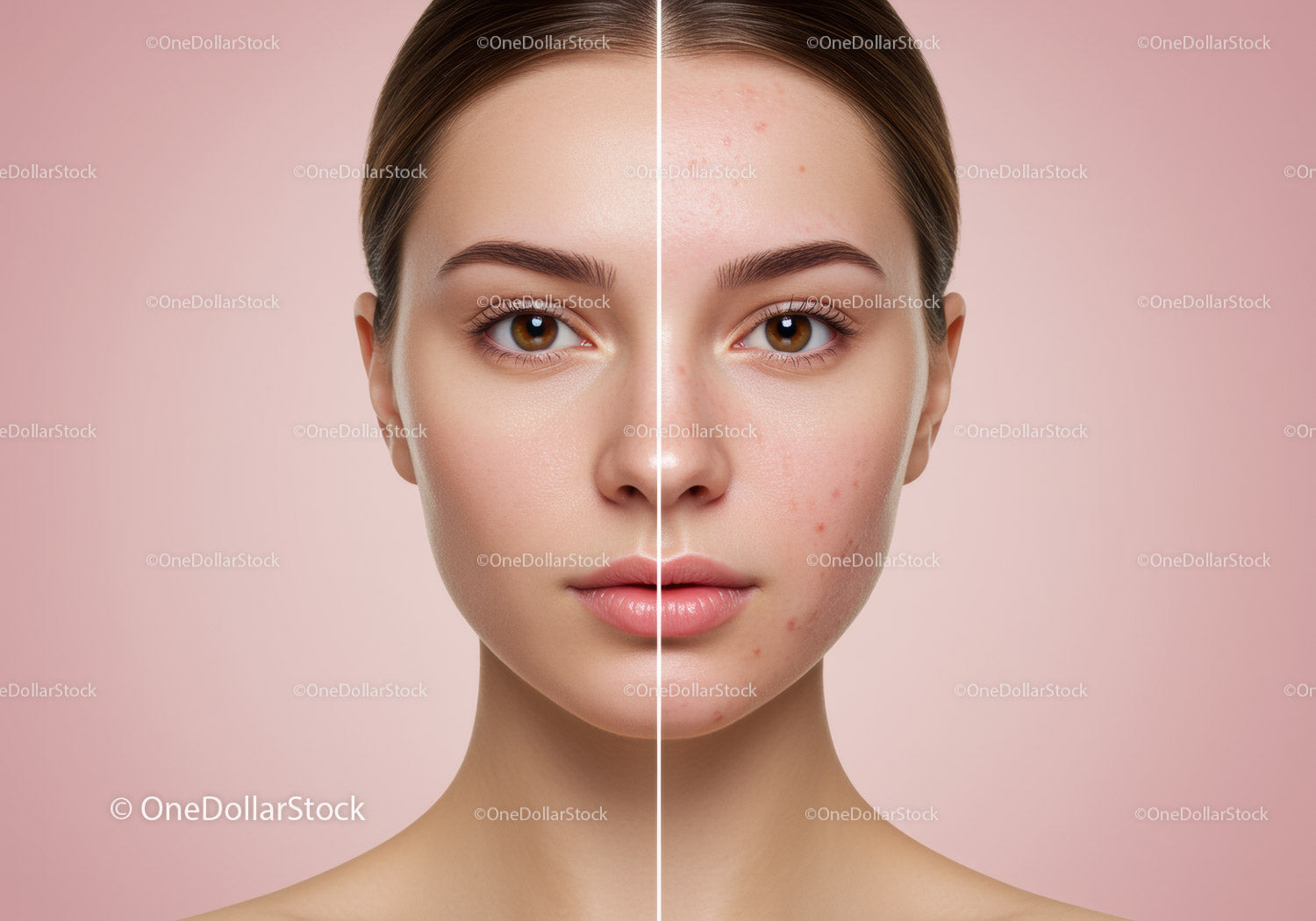 Porównanie pielęgnacji skóry Clear Skin, pokazujące redukcję trądziku i blask