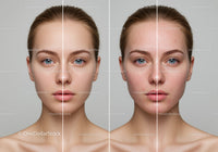 Beautiful Woman Face Showing Clear Skin and Acne Improvement
