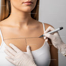 Female Model Receiving Skin Treatment with Marks for Cosmetic Procedure