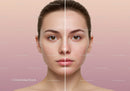 Close-up of Woman with Clear Skin Showing Acne-Free Face