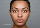 Skincare Transformation of a Woman with Clear and Acne-prone Skin